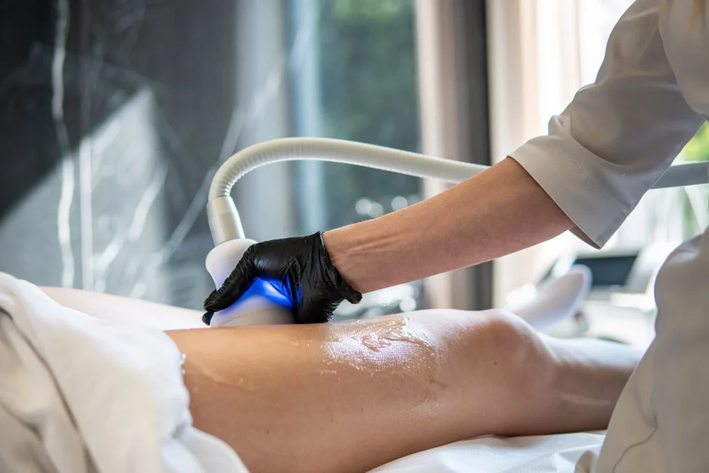 Osoba w białym fartuchu i czarnej rękawiczce używa ręcznego urządzenia z niebieskim światłem, aby wykonać zabieg medycyny estetycznej Wrocław na udzie klienta leżącego na stole przykrytym białym ręcznikiem.