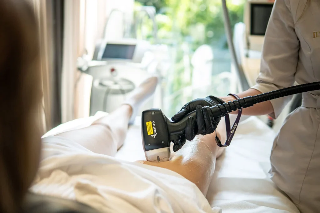 Osoba poddawana zabiegowi depilacji laserowej na podudziu przez profesjonalistę w czarnych rękawiczkach w klinice medycyny estetycznej we Wrocławiu.