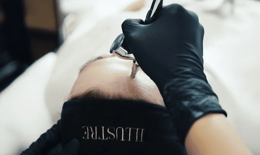 A person wearing black gloves uses an airbrush device on another’s forehead, who is lying down with a black ILLUSTRE headband—an example of advanced medycyna estetyczna Wrocław in a modern klinika medycyny estetycznej.