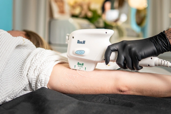 Osoba w białym szlafroku poddaje się zabiegowi kosmetycznemu na ramieniu za pomocą ręcznego urządzenia DUAL HI, obsługiwanego fachowo przez osobę w czarnych rękawiczkach - scena odzwierciedlająca precyzję wrocławskiej medycyny estetycznej.