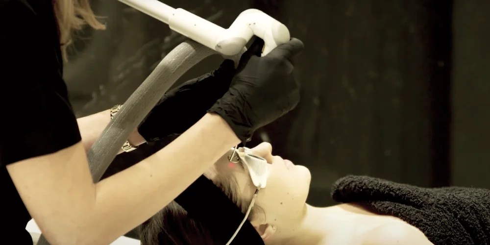 A person lying down with protective eyewear receives a laser facial treatment from a professional wearing black gloves at a klinika medycyny estetycznej.