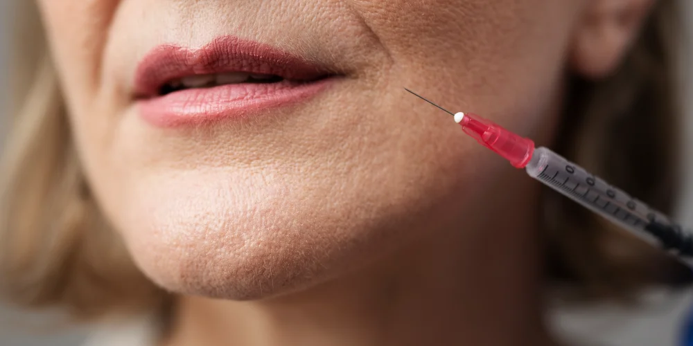 A close-up of a woman’s lower face as she prepares to receive a cosmetic injection in her lips at a klinika medycyny estetycznej, with a syringe held near her mouth.