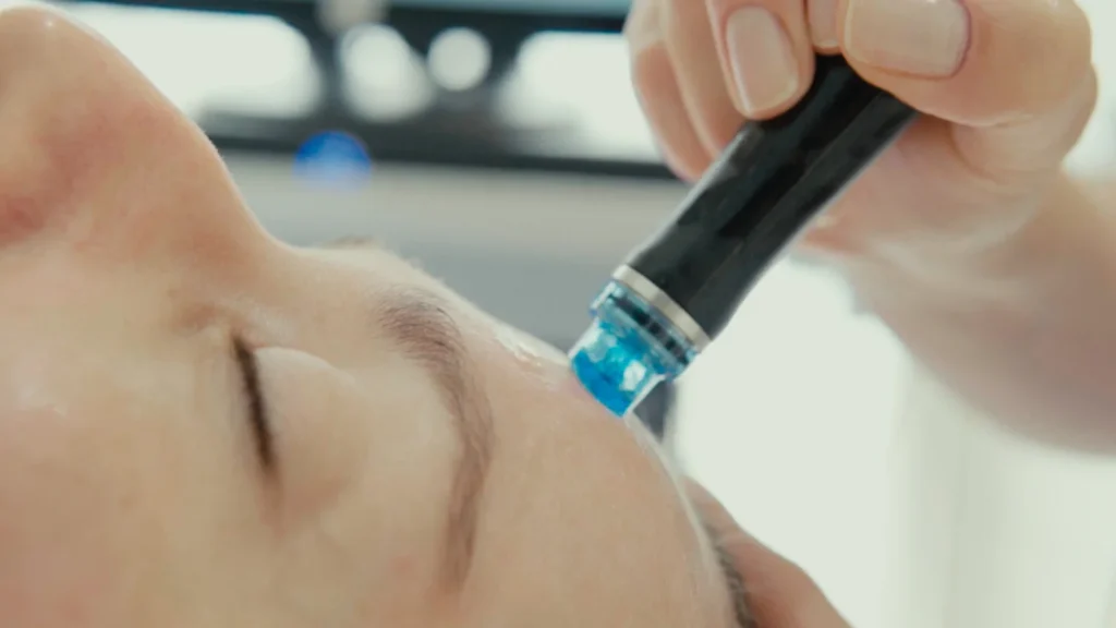 A close-up of a person receiving a facial treatment at a klinika medycyny estetycznej, with a hand holding a device with a blue tip against their cheek. The person's eyes are closed, and the setting appears clinical or spa-like.