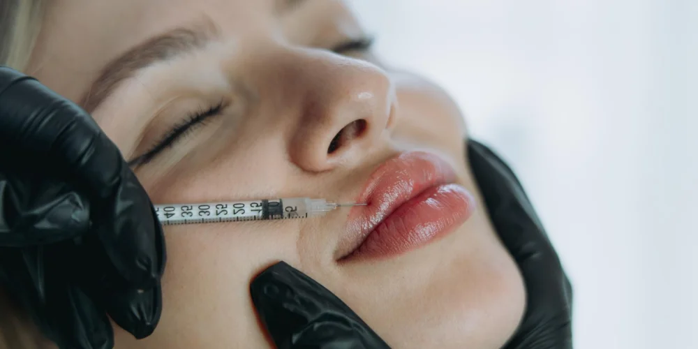 A person with closed eyes receives a cosmetic lip injection from a professional wearing black gloves at a klinika medycyny estetycznej specializing in powiększanie ust Wrocław.
